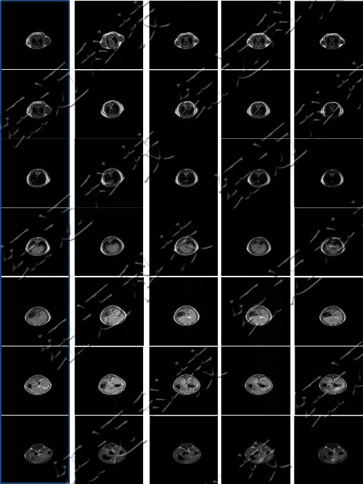 低場(chǎng)核磁共振技術(shù)在造影劑與動(dòng)物成像中的應(yīng)用